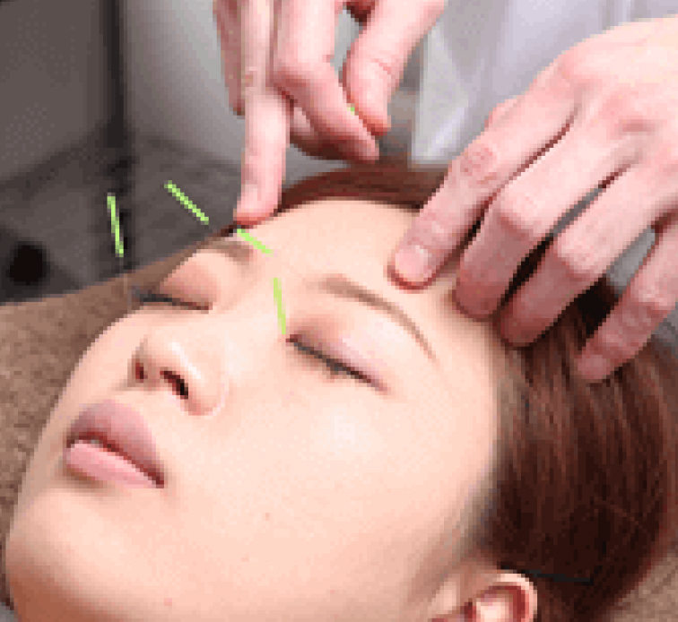 心療内科系の症状専門の都内でも少ない渋谷α鍼灸院