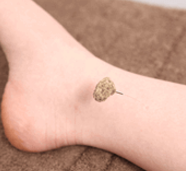 心療内科系の症状専門の都内でも少ない渋谷α鍼灸院